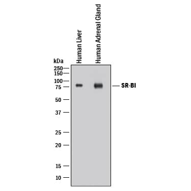 Western blot shows lysates of human liver tissue and human adrenal gland tissue. PVDF membrane was probed with 2 µg/mL of Mouse Anti-Human SR-BI Monoclonal Antibody (Catalog # MAB8114) followed by HRP-conjugated Anti-Mouse IgG Secondary Antibody (Catalog # HAF018). A specific band was detected for SR-BI at approximately 80 kDa (as indicated). This experiment was conducted under reducing conditions and using Immunoblot Buffer Group 1.