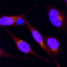 SREBP2 was detected in immersion fixed HeLa human cervical epithelial carcinoma cell line using Goat Anti-Human SREBP2 Antigen Affinity-purified Polyclonal Antibody (Catalog # AF7119) at 15 µg/mL for 3 hours at room temperature. Cells were stained using the NorthernLights™ 557-conjugated Anti-Goat IgG Secondary Antibody (red; Catalog # NL001) and counterstained with DAPI (blue). Specific staining was localized to cytoplasm. View our protocol for Fluorescent ICC Staining of Cells on Coverslips.