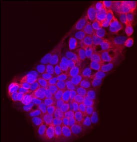 SREBP2 was detected in immersion fixed HepG2 human hepatocellular carcinoma cell line using Mouse Anti-Human SREBP2 Monoclonal Antibody (Catalog # MAB7119) at 10 µg/mL for 3 hours at room temperature. Cells were stained using the NorthernLights™ 557-conjugated Anti-Mouse IgG Secondary Antibody (red; Catalog # NL007) and counterstained with DAPI (blue). Specific staining was localized to cell surfaces and cytoplasm. View our protocol for Fluorescent ICC Staining of Cells on Coverslips.