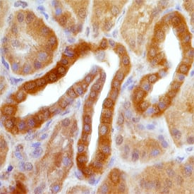 SREBP2 was detected in immersion fixed paraffin-embedded sections of human kidney using Mouse Anti-Human SREBP2 Monoclonal Antibody (Catalog # MAB7119) at 15 µg/mL overnight at 4 °C. Tissue was stained using the Anti-Mouse HRP-DAB Cell & Tissue Staining Kit (brown; Catalog # CTS002) and counterstained with hematoxylin (blue). Specific staining was localized to epithelial cells in convoluted tubules. View our protocol for Chromogenic IHC Staining of Paraffin-embedded Tissue Sections.