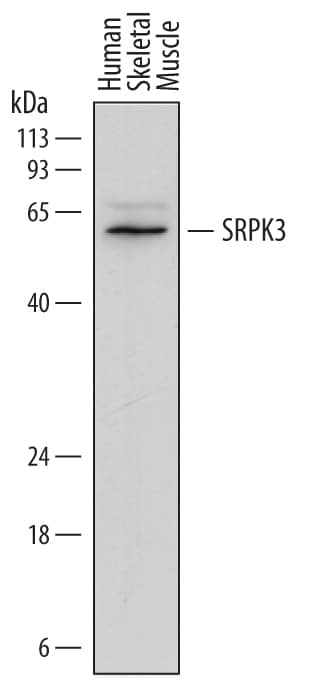 Western Blot SRPK3/STK23 Antibody (722516) [Unconjugated]