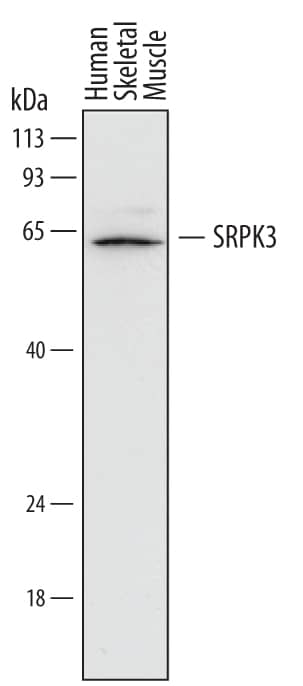 Western Blot SRPK3/STK23 Antibody (722534)