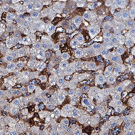 ST2/IL-33 R was detected in immersion fixed paraffin-embedded sections of human liver using Goat Anti-Human ST2/IL-33 R Antigen Affinity-purified Polyclonal Antibody (Catalog # AF523) at 1.7 µg/mL for 1 hour at room temperature followed by incubation with the Anti-Goat IgG VisUCyte™ HRP Polymer Antibody (Catalog # (VC004). Before incubation with the primary antibody, tissue was subjected to heat-induced epitope retrieval using Antigen Retrieval Reagent-Basic (CTS013). Tissue was stained using DAB (brown) and counterstained with hematoxylin (blue). Specific staining was localized to cell membranes. View our protocol for IHC Staining with VisUCyte HRP Polymer Detection Reagents.