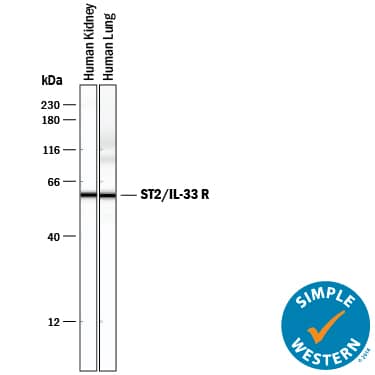 Simple Western lane view shows lysates of human kidney tissue and human lung tissue, loaded at 0.2 mg/mL. A specific band was detected for ST2/IL-33 R at approximately 60 kDa (as indicated) using 2 µg/mL of Goat Anti-Human ST2/IL-33 R Antigen Affinity-purified Polyclonal Antibody (Catalog # AF523) followed by 1:50 dilution of HRP-conjugated Anti-Goat IgG Secondary Antibody (HAF109). This experiment was conducted under reducing conditions and using the 12-230 kDa separation system.