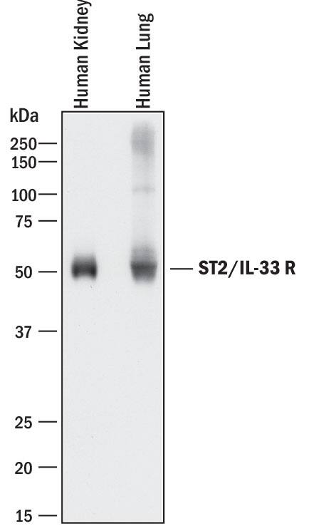 Western blot shows lysates of human kidney tissue and human lung tissue. PVDF membrane was probed with 0.2 µg/mL of Goat Anti-Human ST2/IL-33 R Antigen Affinity-purified Polyclonal Antibody (Catalog # AF523) followed by HRP-conjugated Anti-Goat IgG Secondary Antibody (HAF017). A specific band was detected for ST2/IL-33 R at approximately 50 kDa (as indicated). This experiment was conducted under reducing conditions and using Immunoblot Buffer Group 1.