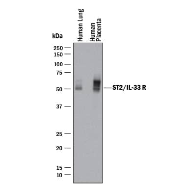 Western blot shows lysates of human lung tissue and human placenta tissue. PVDF membrane was probed with 5 µg/mL of Rabbit Anti-Human ST2/IL-33 R Monoclonal Antibody (Catalog # MAB10118) followed by HRP-conjugated Anti-Rabbit IgG Secondary Antibody (Catalog # HAF008). Specific bands were detected for ST2/IL-33 R at approximately 50-55 kDa (as indicated). This experiment was conducted under reducing conditions and using Immunoblot Buffer Group 1.