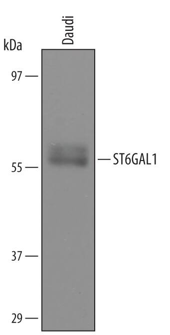 Western blot shows lysates of Daudi human Burkitt's lymphoma cell line. PVDF Membrane was probed with 1 µg/mL of Goat Anti-Human ST6 Gal Sialyltransferase 1/ST6GAL1 Antigen Affinity-purified Polyclonal Antibody (Catalog # AF5924) followed by HRP-conjugated Anti-Goat IgG Secondary Antibody (HAF019). A specific band was detected for ST6GAL1 at approximately 56 kDa (as indicated). This experiment was conducted under reducing conditions and using Immunoblot Buffer Group 8.