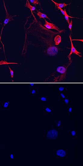 GalNAc a-2,6-sialyltransferase V/ST6GALNAC5 was detected in immersion fixed MDA-MB-231 human breast cancer cell line using Mouse Anti-Human GalNAc a-2,6-sialyltransferase V/ST6GALNAC5 Monoclonal Antibody (Catalog # MAB67151) at 10 µg/mL for 3 hours at room temperature. Cells were stained using the NorthernLights™ 557-conjugated Anti-Mouse IgG Secondary Antibody (red, upper panel; Catalog # NL007) and counterstained with DAPI (blue, lower panel). Specific staining was localized to cell membranes and cytoplasm. View our protocol for Fluorescent ICC Staining of Cells on Coverslips.