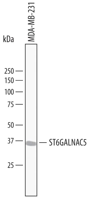Western Blot ST6 GalNAc alpha-2,6-sialyltransferaseV/ST6GALNAC5 Antibody (719526)