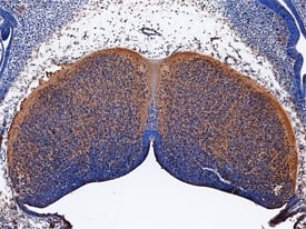 Immunohistochemistry ST8 alpha-2,8-Sialyltransferase 8B/ST8SIA2 Antibody [Unconjugated]