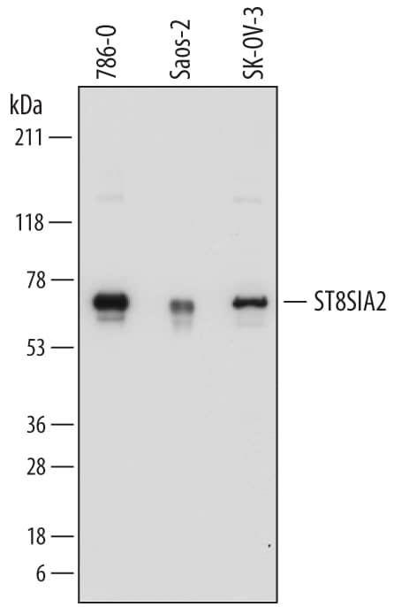 Western Blot ST8 alpha-2,8-Sialyltransferase 8B/ST8SIA2 Antibody [Unconjugated]
