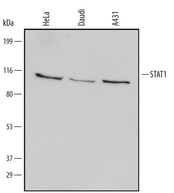 Western blot shows lysates of HeLa human cervical epithelial carcinoma cell line, Daudi human Burkitt's lymphoma cell line, and A431 human epithelial carcinoma cell line. PVDF Membrane was probed with 1 µg/mL of Mouse STAT1 Monoclonal Antibody (Catalog # MAB14091) followed by HRP-conjugated Anti-Mouse IgG Secondary Antibody (Catalog # HAF007). A specific band was detected for STAT1 at approximately 90 kDa (as indicated). This experiment was conducted under reducing conditions and using Immunoblot Buffer Group 1.