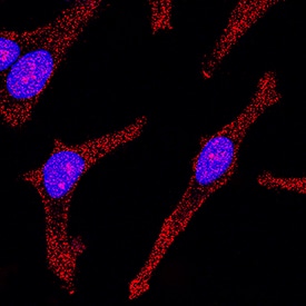 STAT1 was detected in immersion fixed HeLa human cervical epithelial carcinoma cell line using Rat Anti-Human STAT1 Monoclonal Antibody (Catalog # MAB1490) at 3 µg/mL for 3 hours at room temperature. Cells were stained using the NorthernLights™ 557-conjugated Anti-Rat IgG Secondary Antibody (red; Catalog # NL014) and counterstained with DAPI (blue). Specific staining was localized to cytoplasm and nuclei. View our protocol for Fluorescent ICC Staining of Cells on Coverslips.