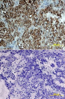 <b>Genetic Strategies Validation. </b>STAT2 was detected in immersion fixed paraffin-embedded sections of human kidney array using Mouse Anti-Human STAT2 Monoclonal Antibody (Catalog # MAB16661) at 25 µg/mL overnight at 4 °C. Tissue was stained using the Anti-Mouse HRP-DAB Cell & Tissue Staining Kit (brown; Catalog # CTS002) and counterstained with hematoxylin (blue). Lower panel shows a lack of labeling if primary antibodies are omitted and tissue is stained only with secondary antibody followed by incubation with detection reagents. View our protocol for Chromogenic IHC Staining of Paraffin-embedded Tissue Sections.
