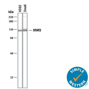 Simple Western lane view shows lysates of K562 human chronic myelogenous leukemia cell line and Daudi human Burkitt's lymphoma cell line, loaded at 0.2 mg/mL. A specific band was detected for STAT2 at approximately 110 kDa (as indicated) using 10 µg/mL of Rat Anti-Human STAT2 Monoclonal Antibody (Catalog # MAB16662) followed by 1:50 dilution of HRP-conjugated Anti-Rat IgG Secondary Antibody (Catalog # HAF005). This experiment was conducted under reducing conditions and using the 12-230 kDa separation system.