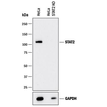Western blot shows lysates of HeLa human cervical epithelial carcinoma parental cell line and STAT2 knockout HeLa cell line (KO). PVDF membrane was probed with 0.5 µg/mL of Goat Anti-Human STAT2 Antigen Affinity-purified Polyclonal Antibody (Catalog # PAF-ST2) followed by HRP-conjugated Anti-Goat IgG Secondary Antibody (Catalog # HAF017). A specific band was detected for STAT2 at approximately 110 kDa (as indicated) in the parental HeLa cell line, but is not detectable in knockout HeLa cell line. GAPDH (Catalog # AF5718) is shown as a loading control. This experiment was conducted under reducing conditions and using Immunoblot Buffer Group 1.