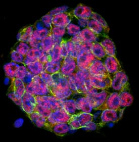 STAT3 was detected in immersion fixed D3 mouse embryonic stem cell line using Goat Anti-Human/Mouse/Rat STAT3 Antigen Affinity-purified Polyclonal Antibody (Catalog # AF1799) at 10 µg/mL for 3 hours at room temperature. Cells were stained using the NorthernLights™ 557-conjugated Anti-Goat IgG Secondary Antibody (red; Catalog # NL001). Tubulin was also detected using Tubulin Antibody (Catalog # NB600-506; Novus Biologicals) and stained using the NorthernLights™ 493-conjugated Anti-Rat IgG Secondary Antibody (green; Catalog # NL015). Cells were counterstained with DAPI (blue). Specific staining of STAT3 was localized to nuclei. View our protocol for Fluorescent ICC Staining of Stem Cells on Coverslips.