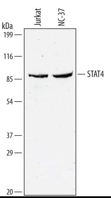 Western blot shows lysates of Jurkat human acute T cell leukemia cell line and NC-37 human Burkitt's lymphoma B lymphoblast cell line. PVDF membrane was probed with 1 µg/mL of Human/Mouse STAT4 Monoclonal Antibody (Catalog # MAB5287) followed by HRP-conjugated Anti-Mouse IgG Secondary Antibody (Catalog # HAF007). A specific band was detected for STAT4 at approximately 90 kDa (as indicated). This experiment was conducted under reducing conditions and using Immunoblot Buffer Group 1.
