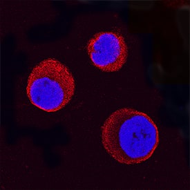 STAT5a was detected in immersion fixed K562 human chronic myelogenous leukemia cell line using Mouse Anti-Human/Mouse STAT5a Monoclonal Antibody (Catalog # MAB2174) at 25 µg/mL for 3 hours at room temperature. Cells were stained using the NorthernLights™ 557-conjugated Anti-Mouse IgG Secondary Antibody (red; Catalog # NL007) and counterstained with DAPI (blue). Specific staining was localized to cytoplasm. View our protocol for Fluorescent ICC Staining of Non-adherent Cells.