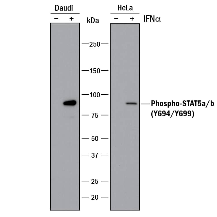 Western blot shows lysates of Daudi human Burkitt's lymphoma cell line and HeLa human cervical epithelial carcinoma cell line untreated (-) or treated (+) with 500 U/mL Recombinant Human IFN-aA (Catalog # 11100-1) for 20 minutes. PVDF membrane was probed with 0.1 µg/mL of Rabbit Anti-Human Phospho-STAT5a/b (Y694/Y699) Monoclonal Antibody (Catalog # MAB41901) followed by HRP-conjugated Anti-Rabbit IgG Secondary Antibody (Catalog # HAF008). A specific band was detected for STAT5a/b at approximately 95 kDa (as indicated). This experiment was conducted under reducing conditions and using Immunoblot Buffer Group 1.