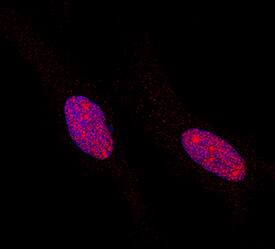 <b>Biological Strategies Validation. </b>STAT5a/b phosphorylated at Y694/Y699 was detected in immersion fixed HeLa human cervical epithelial carcinoma cell line using Rat Anti-Human Phospho-STAT5a/b (Y694/Y699) Monoclonal Antibody (Catalog # MAB4190) at 0.3 µg/mL for 3 hours at room temperature. Cells were stained using the NorthernLights™ 557-conjugated Anti-Rat IgG Secondary Antibody (red; Catalog # NL013) and counterstained with DAPI (blue). Specific staining was localized to nuclei. View our protocol for Fluorescent ICC Staining of Cells on Coverslips.