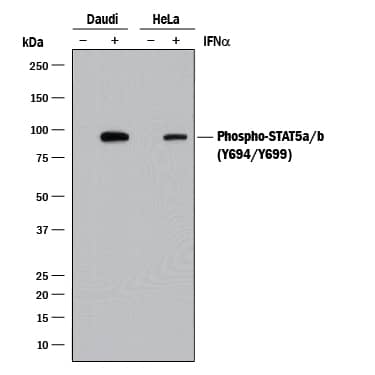 Western blot shows lysates of Daudi human Burkitt's lymphoma cell line and HeLa human cervical epithelial carcinoma cell line untreated (-) or treated (+) with 500 U/mL Recombinant Human IFN-aA (Catalog # 11100-1) for 20 minutes. PVDF membrane was probed with 2 µg/mL of Rat Anti-Human Phospho-STAT5a/b (Y694/Y699) Monoclonal Antibody (Catalog # MAB4190) followed by HRP-conjugated Anti-Rat IgG Secondary Antibody (Catalog # HAF005). A specific band was detected for Phospho-STAT5a/b (Y694/Y699) at approximately 95 kDa (as indicated). This experiment was conducted under reducing conditions and using Immunoblot Buffer Group 1.