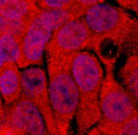 STAT5b was detected in immersion fixed HepG2 human hepatocellular carcinoma cell line using Rabbit Anti-Human/Mouse STAT5b Antigen Affinity-purified Polyclonal Antibody (Catalog # AF1584) at 5 µg/mL for 3 hours at room temperature. Cells were stained using the NorthernLights™ 557-conjugated Anti-Rabbit IgG Secondary Antibody (red; NL004) and counterstained with DAPI(blue). Specific staining was localized to cytoplasm and nucleus. View our protocol for Fluorescent ICC Staining of Cells on Coverslips.