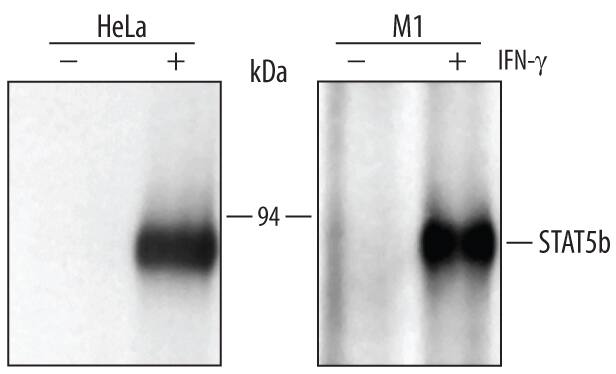 HeLa human cervical epithelial carcinoma and M1 mouse myeloid leukemia cell line were untreated (-) or activated (+) with 100 ng/mL Recombinant Human IFN-gamma (285-IF) for 15 minutes. STAT5b was immunoprecipitated from lysates of 5 x 106cells following incubation with 2 µg Rabbit Anti-Human/Mouse STAT5b Antigen Affinity-purified Polyclonal Antibody (Catalog # AF1584) for 1 hour at room temperature. STAT5b-antibody complexes were absorbed using Protein A sepharose (Invitrogen, Catalog # 10-1041). Immunoprecipitated STAT5b was detected by Western blot using 1 µg/mL Human Phospho-STAT5a/b (Y699) Antigen Affinity-purified Polyclonal Antibody (AF4190). View our recommended buffer recipes for immunoprecipitation.