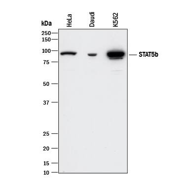 Western blot shows lysates of HeLa human cervical epithelial carcinoma cell line, Daudi human Burkitt's lymphoma cell line, and K562 human chronic myelogenous leukemia cell line. PVDF membrane was probed with 1 µg/mL of Mouse Anti-Human STAT5b Monoclonal Antibody (Catalog # MAB1584) followed by HRP-conjugated Anti-Mouse IgG Secondary Antibody (HAF018). A specific band was detected for STAT5b at approximately 90 kDa (as indicated). This experiment was conducted under reducing conditions and using Immunoblot Buffer Group 1.