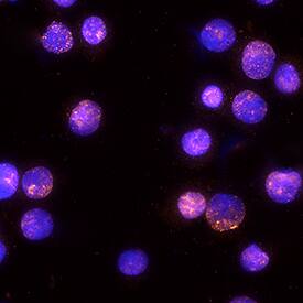 STAT6 phosphorylated at Y641 was detected in immersion fixed U937 human histiocytic lymphoma cell line treated with Recombinant Human IL-4 (Catalog # 204-IL) using Rat Anti-Human Phospho-STAT6 Y641 Monoclonal Antibody (Catalog # MAB37172) at 25 µg/mL for 3 hours at room temperature. Cells were stained using the NorthernLights™ 557-conjugated Anti-Rat IgG Secondary Antibody (red; Catalog # NL013) and counterstained with DAPI (blue). Specific staining was localized to nuclei. View our protocol for Fluorescent ICC Staining of Non-adherent Cells.