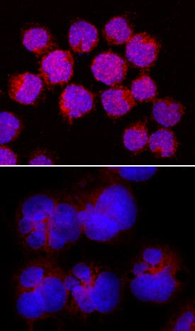 <b>Biological Strategies Validation. </b>STAT6 phosphorylated at Y641 was detected in immersion fixed Daudi human Burkitt's lymphoma cell line, untreated (lower panel) or treated with Recombinant Human IL-4 (Catalog # 204-IL; upper panel) using Rabbit Anti-Human Phospho-STAT6 (Y641) Monoclonal Antibody (Catalog # MAB3717) at 5 µg/mL for 3 hours at room temperature. Cells were stained using the NorthernLights™ 557-conjugated Anti-Rabbit IgG Secondary Antibody (red; Catalog # NL004) and counterstained with DAPI (blue). Specific staining was localized to cytoplasm. View our protocol for Fluorescent ICC Staining of Non-adherent Cells.
