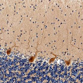 STIM1 was detected in immersion fixed paraffin-embedded sections of human brain (cerebellum) using Mouse Anti-Human STIM1 Monoclonal Antibody (Catalog # MAB69761) at 15 µg/mL overnight at 4 °C. Before incubation with the primary antibody, tissue was subjected to heat-induced epitope retrieval using Antigen Retrieval Reagent-Basic (Catalog # CTS013). Tissue was stained using the Anti-Mouse HRP-DAB Cell & Tissue Staining Kit (brown; Catalog # CTS002) and counterstained with hematoxylin (blue). Specific staining was localized to cytoplasm in Purkinje neurons. View our protocol for Chromogenic IHC Staining of Paraffin-embedded Tissue Sections.