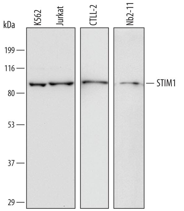 Western blot shows lysates of K562 human chronic myelogenous leukemia cell line, Jurkat human acute T cell leukemia cell line, CTLL-2 mouse cytotoxic T cell line, and Nb2-11 rat lymphoma cell line. PVDF membrane was probed with 1 µg/mL of Mouse Anti-Human/Mouse/Rat STIM1 Monoclonal Antibody (Catalog # MAB6976) followed by HRP-conjugated Anti-Mouse IgG Secondary Antibody (Catalog # HAF007). A specific band was detected for STIM1 at approximately 86 kDa (as indicated). This experiment was conducted under reducing conditions and using Immunoblot Buffer Group 1.
