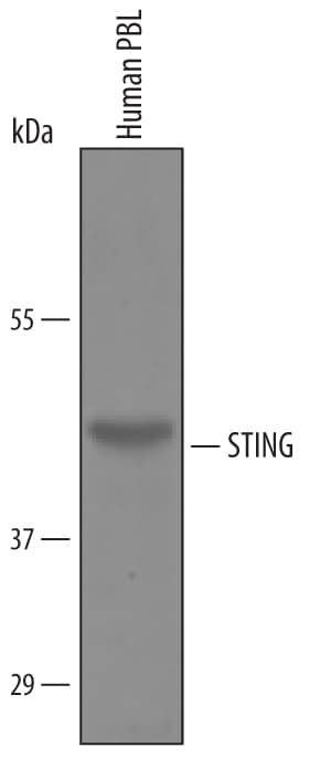 Western blot shows lysates of human peripheral blood lymphocytes (PBL). PVDF Membrane was probed with 1 µg/mL of Human/Mouse STING/TMEM173 Antigen Affinity-purified Polyclonal Antibody (Catalog # AF6516) followed by HRP-conjugated Anti-Sheep IgG Secondary Antibody (Catalog # HAF016). A specific band was detected for STING/TMEM173 at approximately 42 kDa (as indicated). This experiment was conducted under reducing conditions and using Immunoblot Buffer Group 8.
