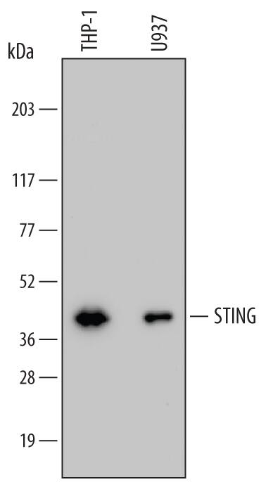Western blot shows lysates of THP-1 human acute monocytic leukemia cell line and U937 human histiocytic lymphoma cell line. PVDF membrane was probed with 0.2 µg/mL of Mouse Anti-Human STING/TMEM173 Monoclonal Antibody (Catalog # MAB7169) followed by HRP-conjugated Anti-Mouse IgG Secondary Antibody (HAF007). A specific band was detected for STING/TMEM173 at approximately 40 kDa (as indicated). This experiment was conducted under reducing conditions and using Immunoblot Buffer Group 1.