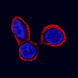 STRA6 was detected in immersion fixed Raji human Burkitt's lymphoma cell line using Mouse Anti-Human STRA6 Monoclonal Antibody (Catalog # MAB5904) at 3 µg/mL for 3 hours at room temperature. Cells were stained using the NorthernLights™ 557-conjugated Anti-Mouse IgG Secondary Antibody (red; Catalog # NL007) and counterstained with DAPI (blue). Specific staining was localized to plasma membrane and cytoplasm. View our protocol for Fluorescent ICC Staining of Non-adherent Cells.