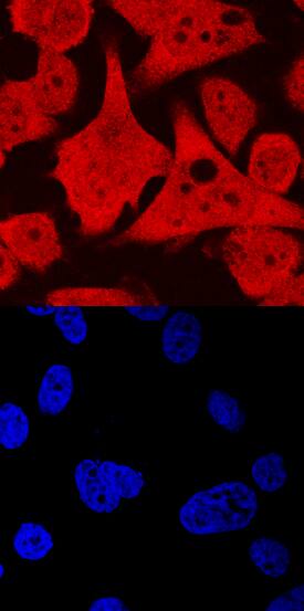 Immunocytochemistry STYK1 Antibody (484713)
