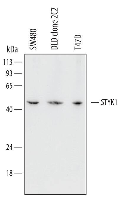 Western Blot STYK1 Antibody (484713)