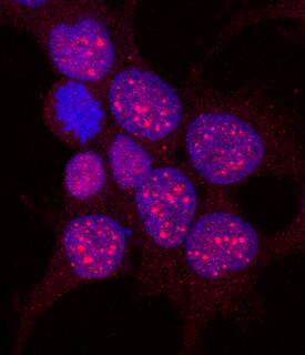 SUMO3 was detected in immersion fixed HEK293 human embryonic kidney cell line using Recombinant Rat Anti-Human SUMO3 Monoclonal Antibody (Catalog # MAB2959R) at 10 µg/mL for 3 hours at room temperature. Cells were stained using the NorthernLights™ 557-conjugated Anti-Rat IgG Secondary Antibody (red; Catalog # NL013) and counterstained with DAPI (blue). Specific staining was localized to nuclei. View our protocol for Fluorescent ICC Staining of Cells on Coverslips.