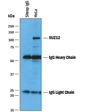 Immunoprecipitation SUZ12 Antibody [Unconjugated]