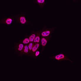 Immunocytochemistry SUZ12 Antibody (448909) [Unconjugated]