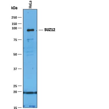 Immunoprecipitation SUZ12 Antibody (448909) [Unconjugated]