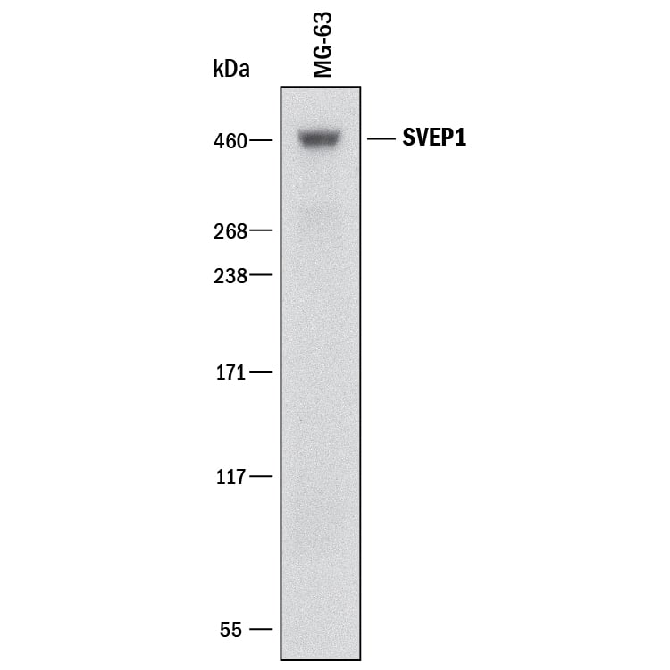 Western blot shows lysates of MG-63 human osteosarcoma cell line. PVDF membrane was probed with 2 µg/mL of Mouse Anti-Human SVEP1 Monoclonal Antibody (Catalog # MAB97741) followed by HRP-conjugated Anti-Mouse IgG Secondary Antibody (Catalog # HAF018). A specific band was detected for SVEP1 at approximately 460 kDa (as indicated). This experiment was conducted under reducing conditions and using Immunoblot Buffer Group 3.