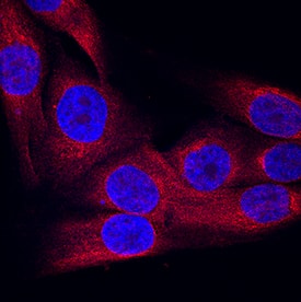 SVEP1 was detected in immersion fixed MG-63 human osteosarcoma cell line using Mouse Anti-Human SVEP1 Monoclonal Antibody (Catalog # MAB9774) at 8 µg/mL for 3 hours at room temperature. Cells were stained using the NorthernLights™ 557-conjugated Anti-Mouse IgG Secondary Antibody (red; Catalog # NL007) and counterstained with DAPI (blue). Specific staining was localized to cytoplasm. View our protocol for Fluorescent ICC Staining of Cells on Coverslips.