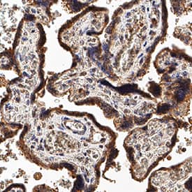 SVEP1 was detected in immersion fixed paraffin-embedded sections of human placenta using Mouse Anti-Human SVEP1 Monoclonal Antibody (Catalog # MAB9774) at 5 µg/mL for 1 hour at room temperature followed by incubation with the Anti-Mouse IgG VisUCyte™ HRP Polymer Antibody (Catalog # VC001). Tissue was stained using DAB (brown) and counterstained with hematoxylin (blue). Specific staining was localized to cytoplasm in syncytiotrophoblasts. View our protocol for IHC Staining with VisUCyte HRP Polymer Detection Reagents.