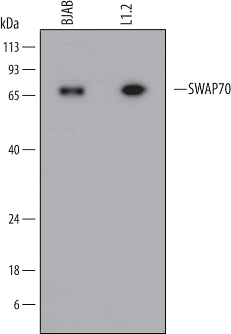 Western blot shows lysates of BJAB human Burkitt's lymphoma cell line and L1.2 mouse pro-B cell line. PVDF Membrane was probed with 1 µg/mL of Mouse Anti-Human/Mouse SWAP70 Monoclonal Antibody (Catalog # MAB6735) followed by HRP-conjugated Anti-Mouse IgG Secondary Antibody (Catalog # HAF007). A specific band was detected for SWAP70 at approximately 70 kDa (as indicated). This experiment was conducted under reducing conditions and using Immunoblot Buffer Group 1.