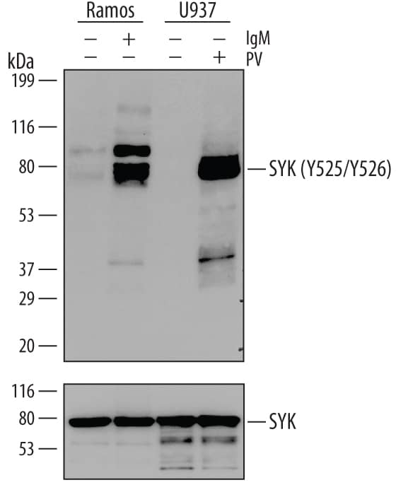 Western Blot SYK [p Tyr525, p Tyr526, p Tyr526] Antibody (616268)