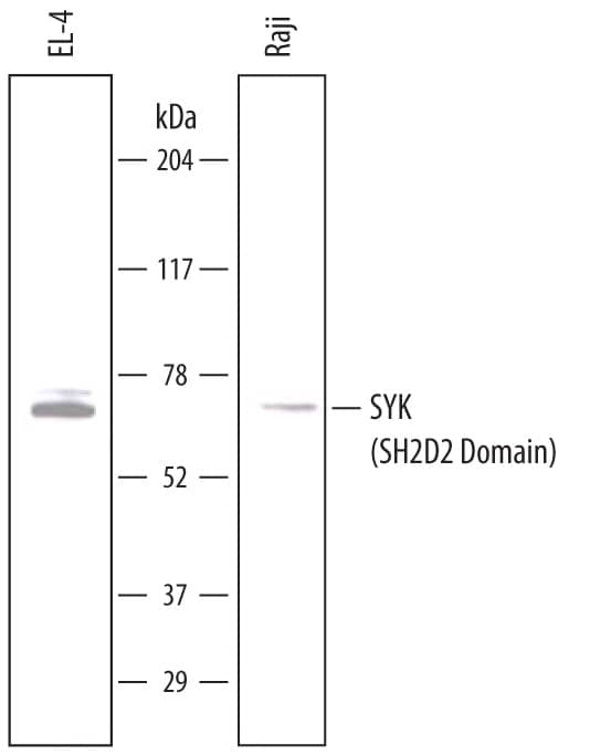 Western Blot SYK Antibody (720402) [Unconjugated] - (SH2D2 Domain)