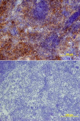 Sca-1/Ly6 was detected in perfusion fixed frozen sections of mouse thymus using Mouse Sca-1/Ly6 Biotinylated Monoclonal Antibody (Catalog # BAM1226) at 25 µg/mL overnight at 4 °C. Tissue was stained using the Anti-Rat HRP-DAB Cell & Tissue Staining Kit (brown; Catalog # CTS017) and counterstained with hematoxylin (blue). Lower panel shows a lack of labeling if primary antibodies are omitted and tissue is stained only with secondary antibody followed by incubation with detection reagents. View our protocol for Chromogenic IHC Staining of Frozen Tissue Sections.