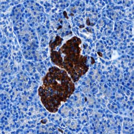 Immunohistochemistry Secretagogin Antibody (778518) [Unconjugated]